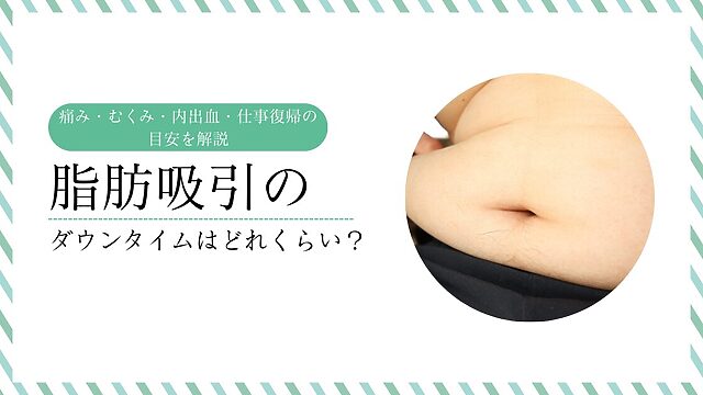 脂肪吸引のダウンタイムについて、痛み・むくみ・内出血・仕事復帰の目安を解説するアイキャッチ画像
