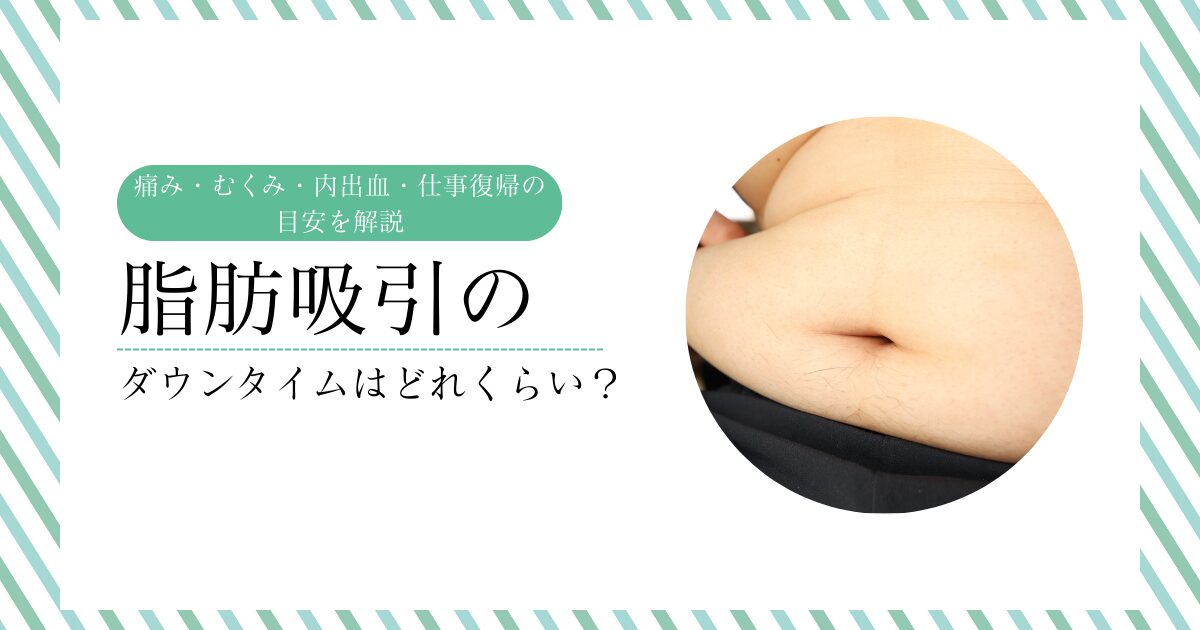 脂肪吸引のダウンタイムについて、痛み・むくみ・内出血・仕事復帰の目安を解説するアイキャッチ画像